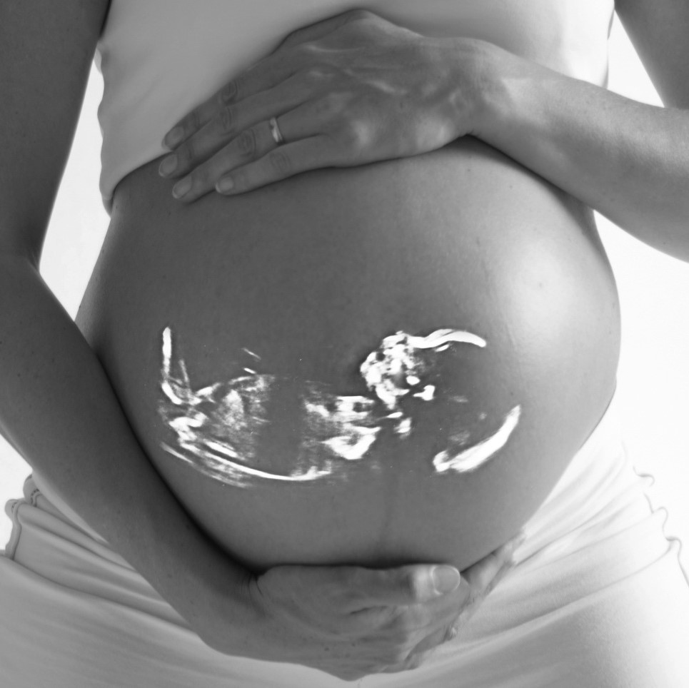 Femme enceinte avec silhouette d'échographie en surimpression